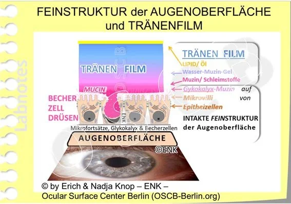 D-BLICK auf ... Tränen und Tränenfilm — Ocular Surface Center Berlin